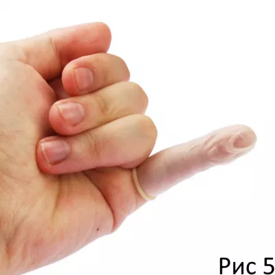 Медицинские напальчники "Medical Fingercot S"