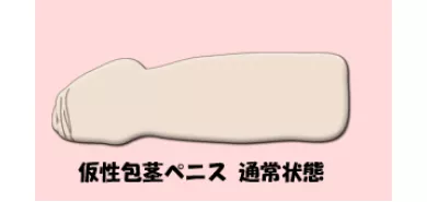 Кольцо ретрактор с турмалином "My Lap Turmaline"