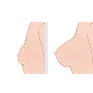 Вибромассажер груди ''Raizu Breast Massager''